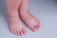 Why Do Feet Become Swollen During Pregnancy?