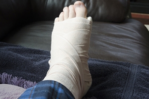 Broken Feet From Dog Bites