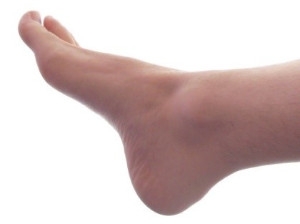 Anxiety and Depression May Contribute to Hyperhidrosis